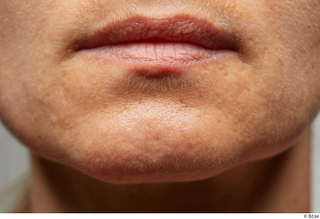 HD Face Skin Judy Tranz chin face lips mouth skin…